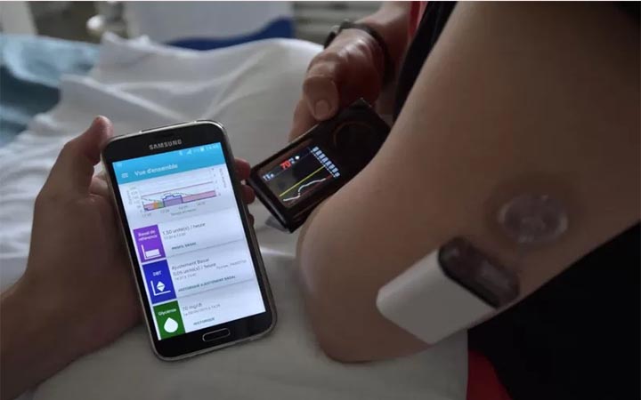 যেভাবে ধীরে ধীরে বদলে যাচ্ছে ডায়াবেটিসের চিকিৎসা