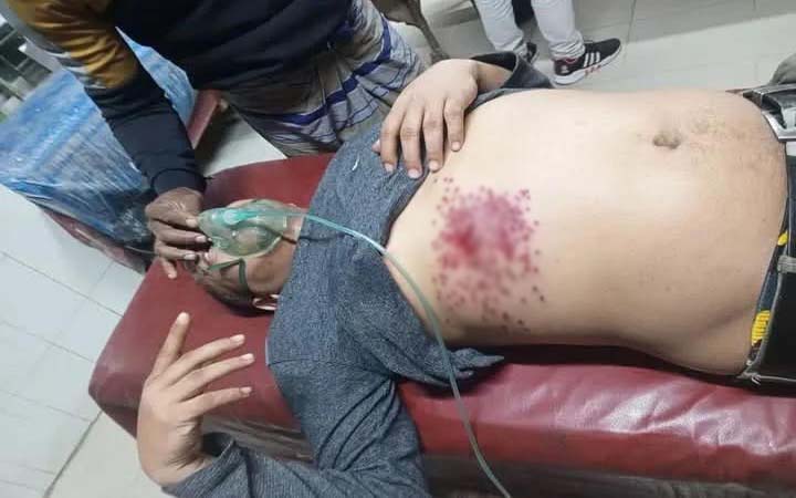 নোয়াখালীতে চাঁদাবাজির টাকা নিয়ে বিএনপির দুগ্রুপের সংঘর্ষ, যুবদল নেতা গুলিবিদ্ধ