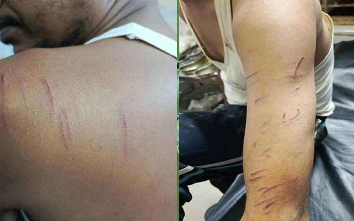 ছাত্রলীগ নেতাকে ধরতে গিয়ে হামলা শিকার ২ পুলিশ সদস্য