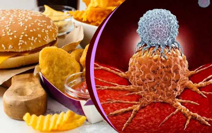 অস্ট্রেলিয়ার গবেষণায় জানা গেল অস্বাস্থ্যকর খাদ্যাভ্যাস ক্যান্সারের ঝুঁকি বাড়ায়