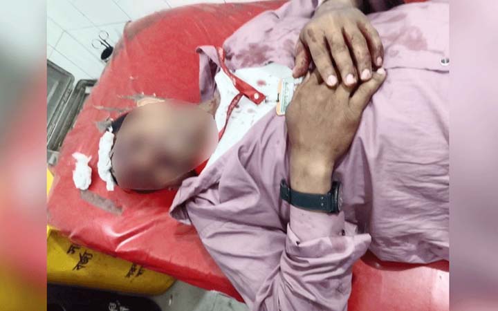 সন্ত্রাসী হামলায় গুরুতর আহত সাংবাদিক