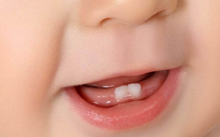 শিশুর নতুন দাঁত উঠলে পিঠা খাওয়াতে হয়?