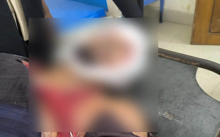 ব্রাহ্মণবাড়িয়ার বাঞ্ছারামপুরে অটোরিকশার ধাক্কায়  কাঠমিস্ত্রির মৃত্যু