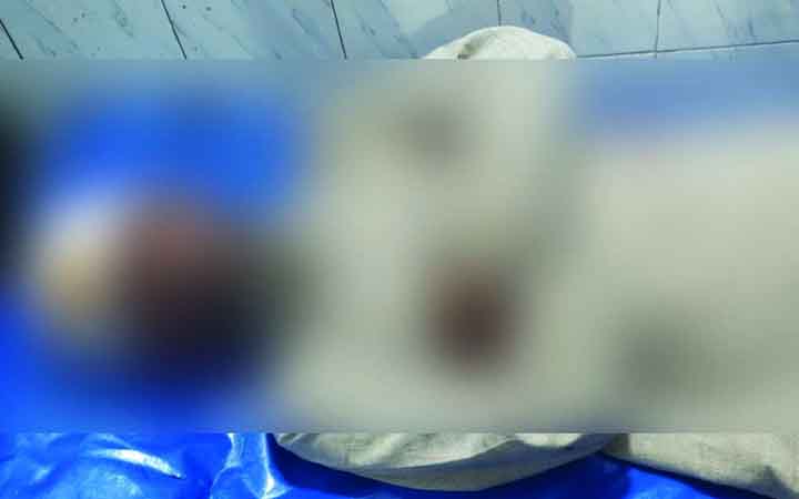 পিরোজপুরে আ. লীগ নেতার হামলায় বিএনপি নেতা জখম, আহত পাঁচ