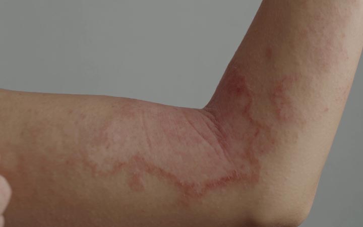 দেশে নতুন ছোঁয়াচে ‘মহামারি’, প্রাদুর্ভাব বাড়ছে