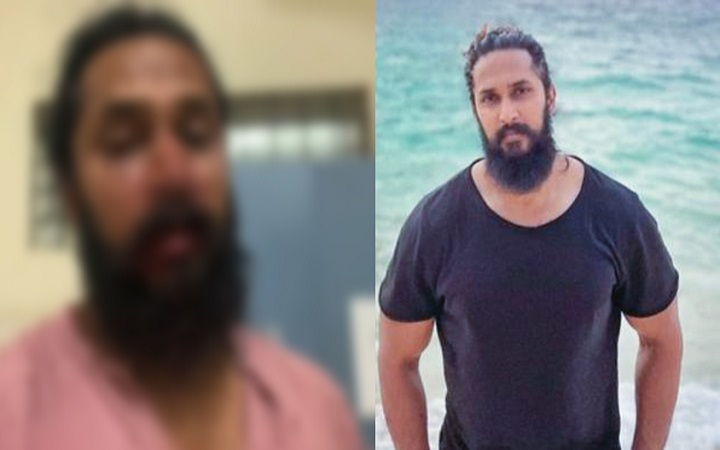 মেরে অভিনেতার নাক ভেঙে দিয়েছে দুর্বৃত্তরা