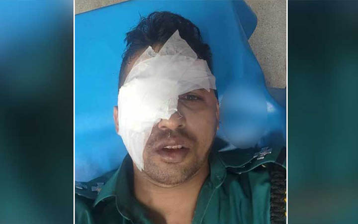 হিজড়াদের হামলায় চোখ হারালেন এসআই