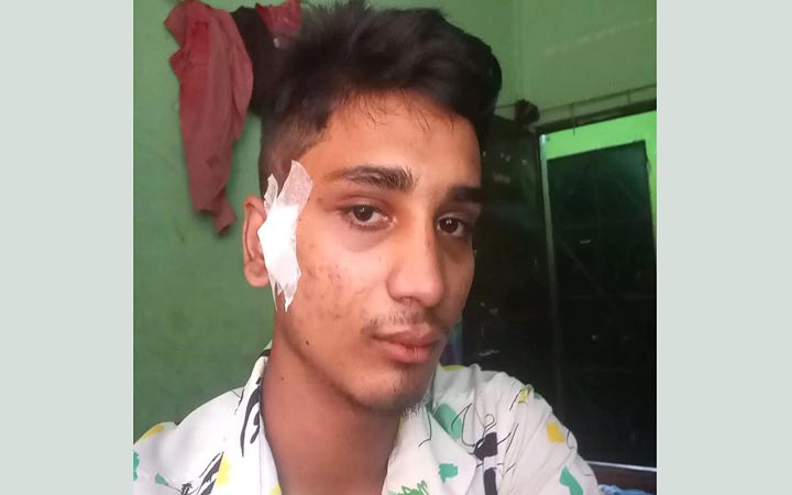 বাউফলে জুলাই আন্দোলনে আহত হৃদয়ের মৃত্যু