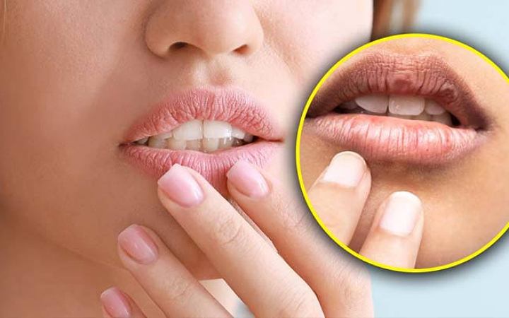 জেনে নিন শুষ্ক দিনে ঠোঁটের যত্ন