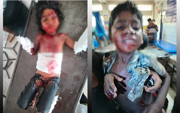 যশোরে বসত বাড়িতে বোমা বিস্ফোরণে  ১ শিশু নিহত আহত ১