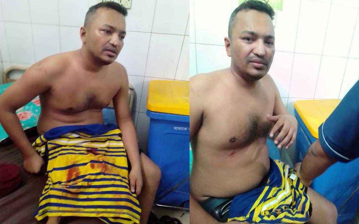 ছাত্রদলের সাবেক সভাপতি শ্রাবণের ওপর ছাত্রলীগের হামলা