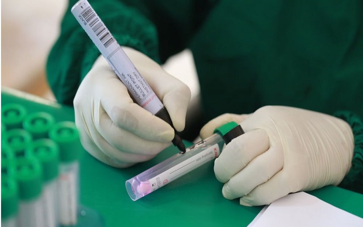 যশোরে নারী শরীরে করোনা নতুন ভেরিয়েন্ট শনাক্ত