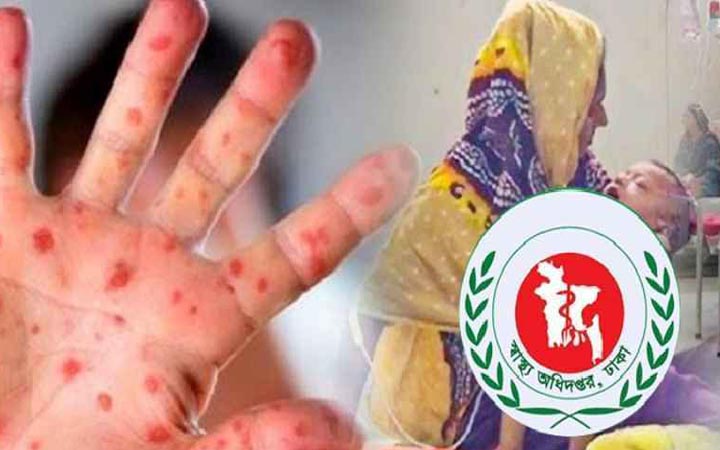 হাম ও উপসর্গে সাড়ে ৬ মাসে ১১১০ জনের মৃত্যু