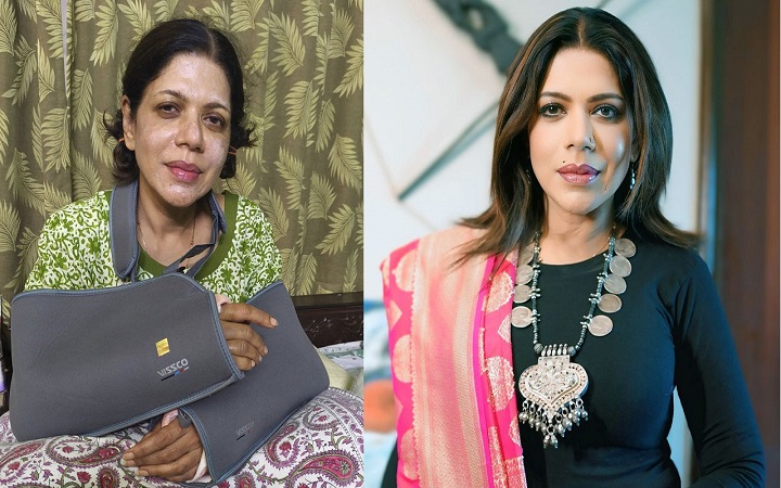 একসঙ্গে দু'হাত ভাঙলেন অভিনেত্রী নন্দিনী