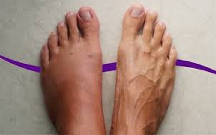 দীর্ঘক্ষণ বসে কাজ করলেই পা ফুলে যায়? মেনে চলুন কিছু নিয়ম