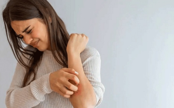 ত্বকের সংক্রমণ কমাতে বর্ষাকালে কী করবেন