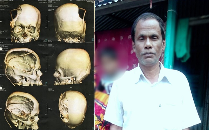 চুল কাটতে বলায় হামলা: ১১ মাস চিকিৎসাধীন থাকার পর সেই বৃদ্ধের মৃত্যু