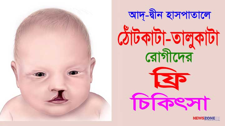 আদ্-দ্বীন হাসপাতালে ঠোঁটকাটা-তালুকাটা রোগীদের ফ্রি চিকিৎসা